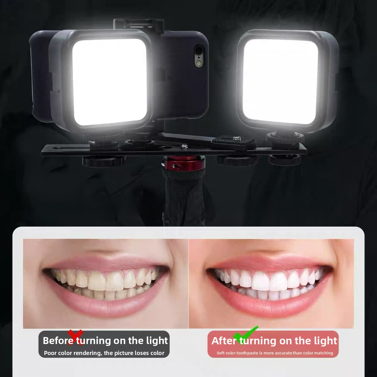 Photography Lighting Lamp - Dental Photography Light with Bluetooth Oral