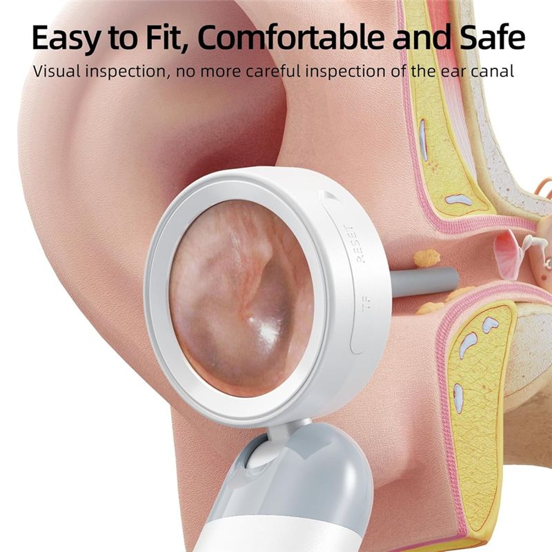 LXYB18B Wireless Ear Otoscope  - Macro Photography Led Lighting recension och pris