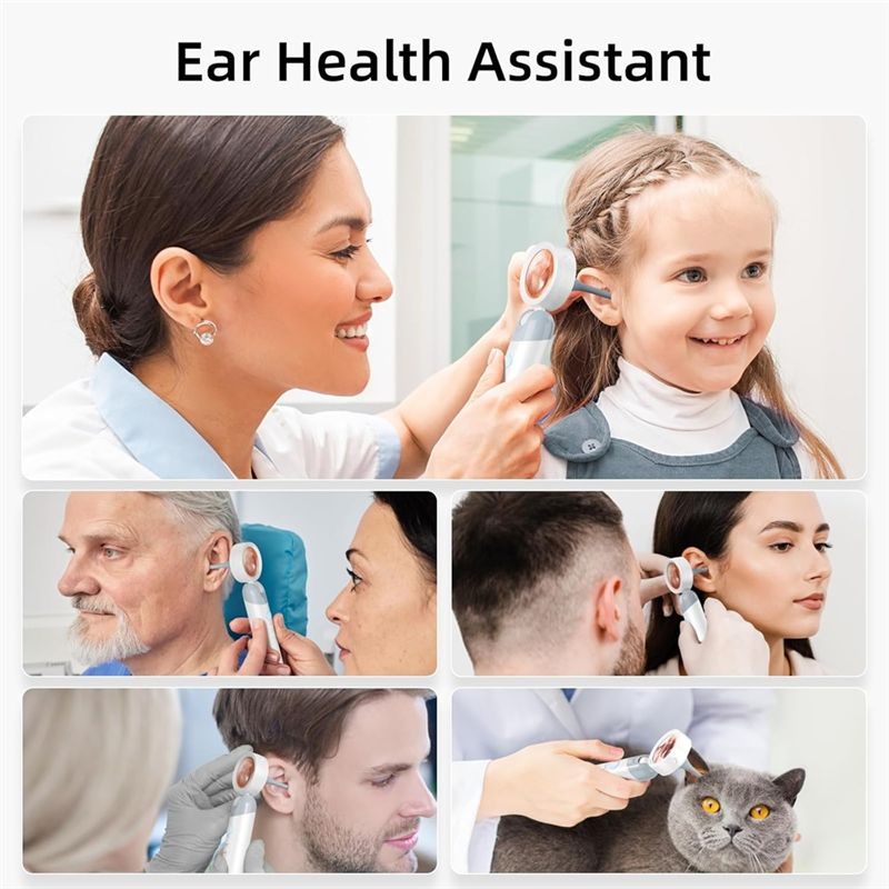 LXYB18B Wireless Ear Otoscope  - Macro Photography Led Lighting recension och pris